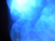 Prossima Foto: luce e colore